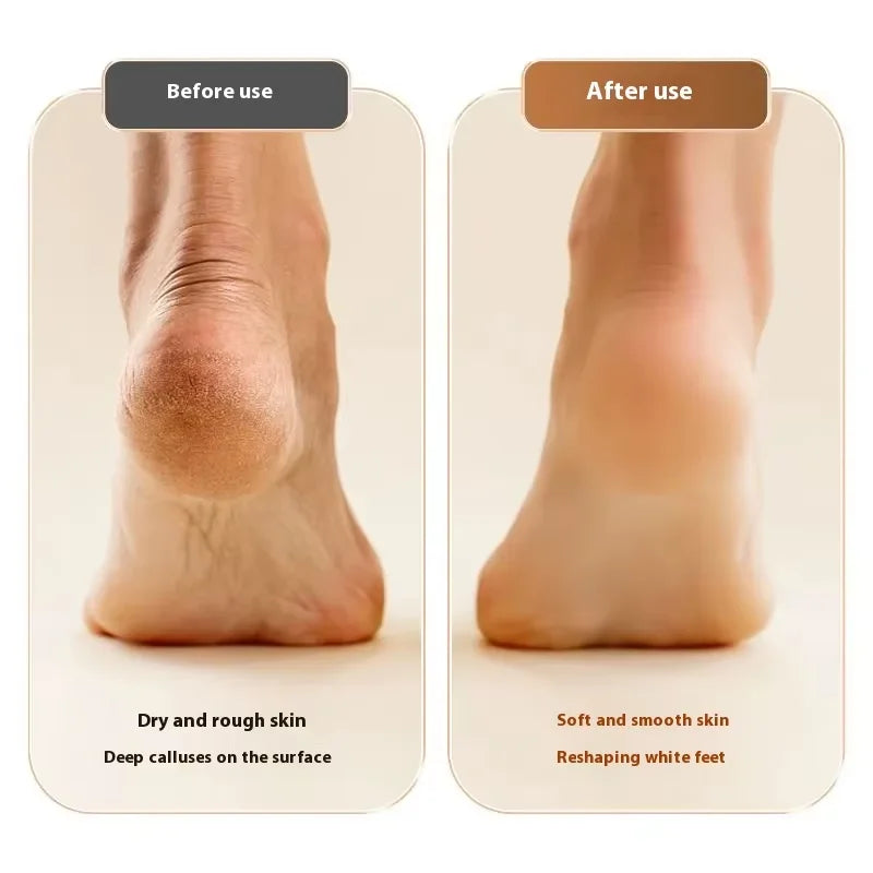 Electric Foot Grinder Callus Remover - Salon-Smooth Feet at Home (With 3 Heads)