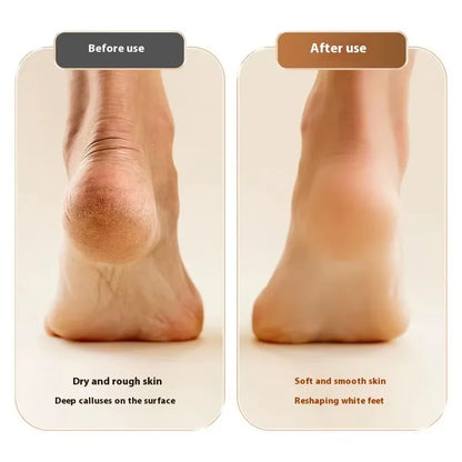 Electric Foot Grinder Callus Remover - Salon-Smooth Feet at Home (With 3 Heads)