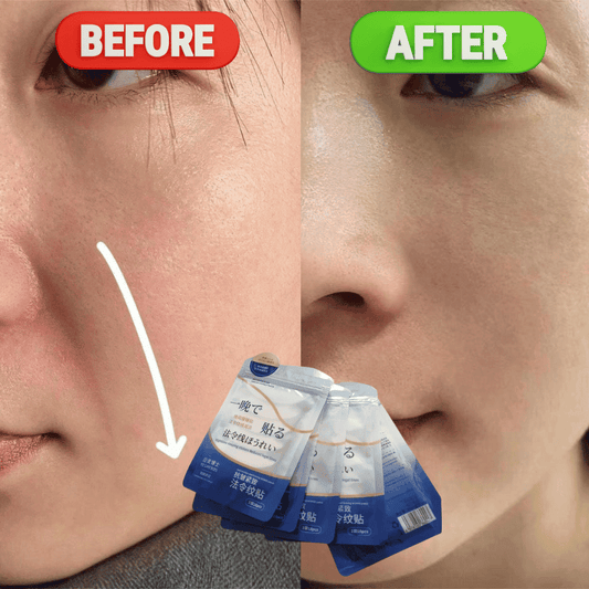 Tri-Combo Smile Lines Eraser Patches – Straffende Centella-Peptid-Kollagen-Mischung (18 Patches pro Packung)